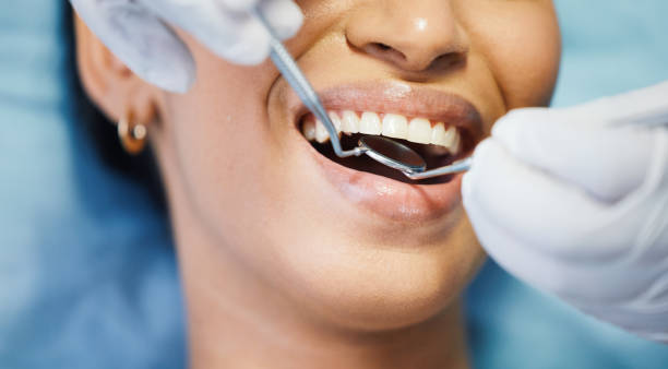 Best Emergency Tooth Extraction in O, MI