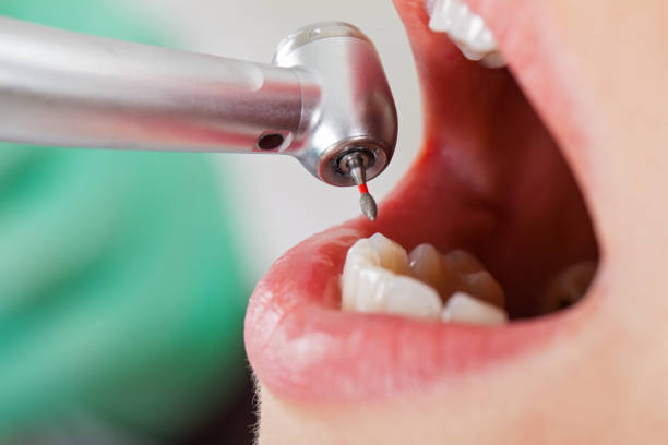 Best Weekend Emergency Dentist in O, MI